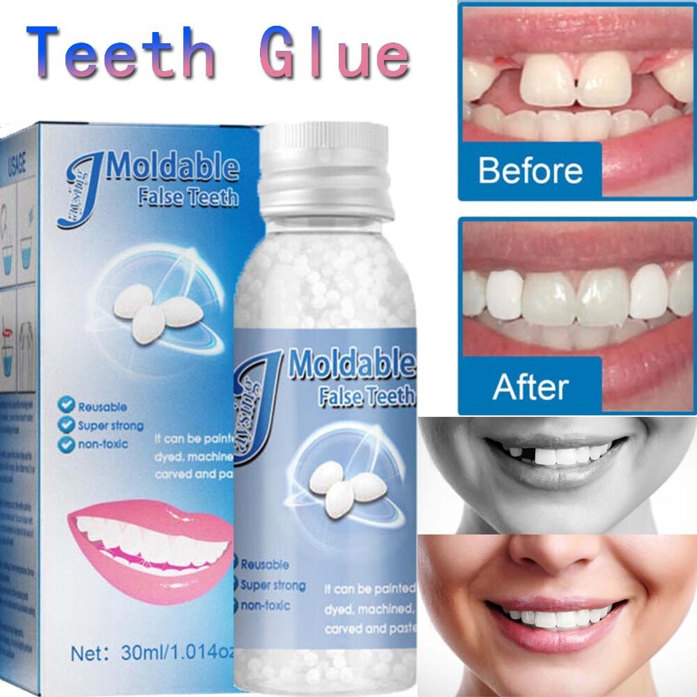 False Teeth Solid Glue Temporary Tooth Repair Resin Moldable Teeth Gap Denture