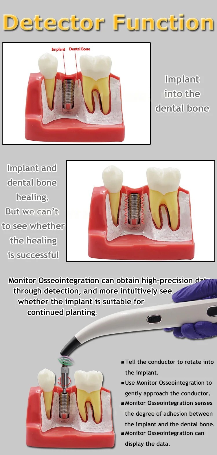Monitor Osseointegration RFA Inplant Stability Measurement Test Unit US Dental