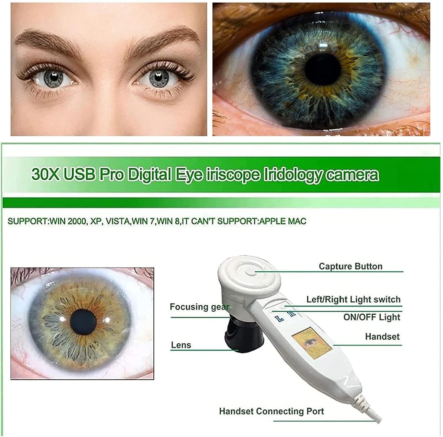 Analyzer Camera HD Iriscope Eye Camera with English Analysis Software for Eye US