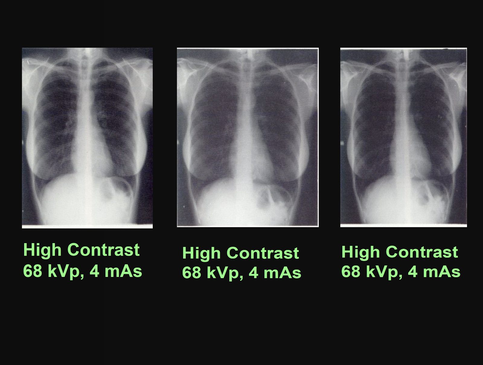 326 Page RADIOLOGY IMAGE ANALYSIS Density Contrast Quality Presentations on CD