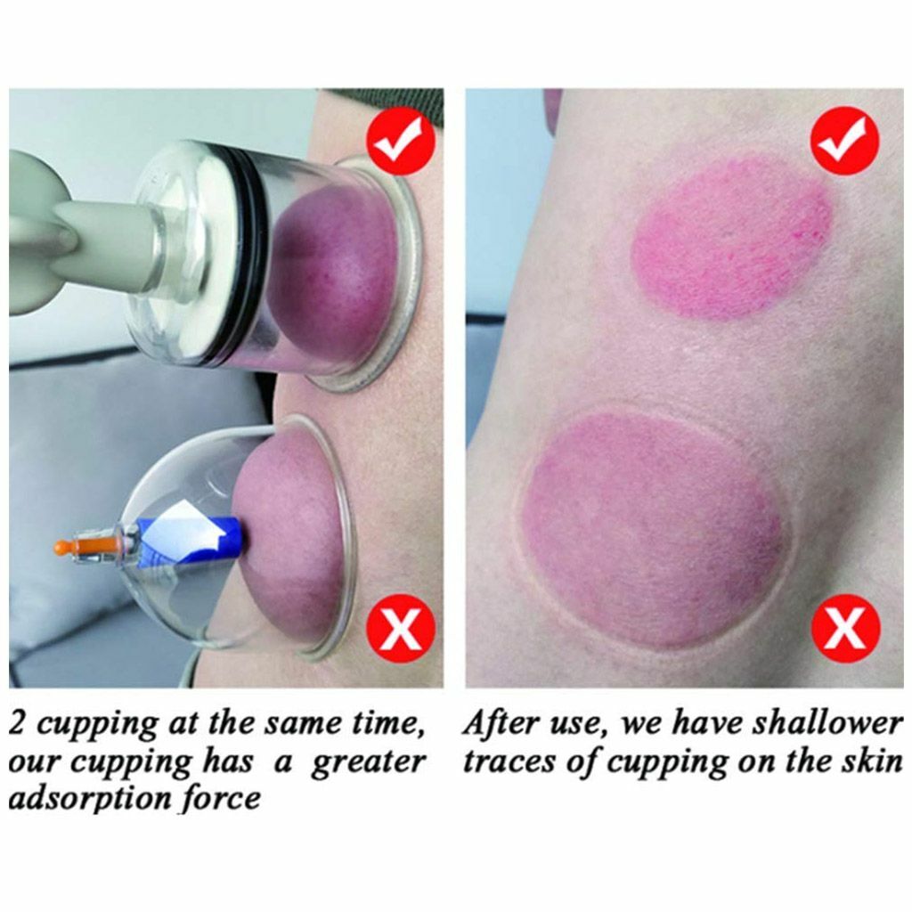 1-2PCS Vacuum Twist Rotary Cupping Set Nipple Sucker Enlargement NO-Pump Suction