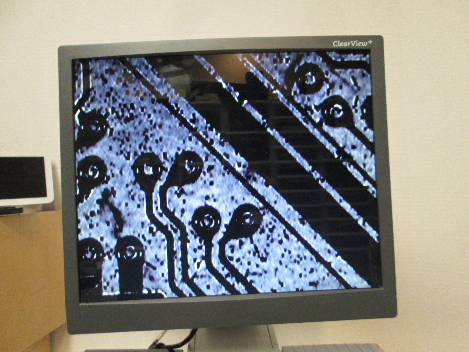 Optelec ClearView+ Plus Low Vision Video Magnifier