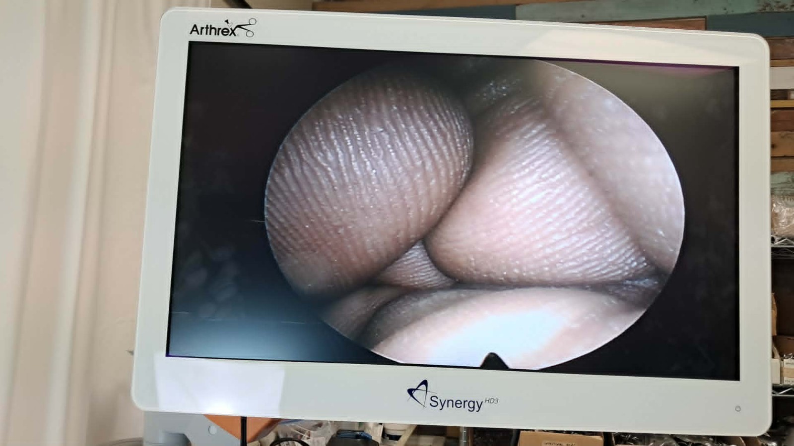 Richard Wolf 8880.433 Panoview Plus Arthroscope 4mm x 25º