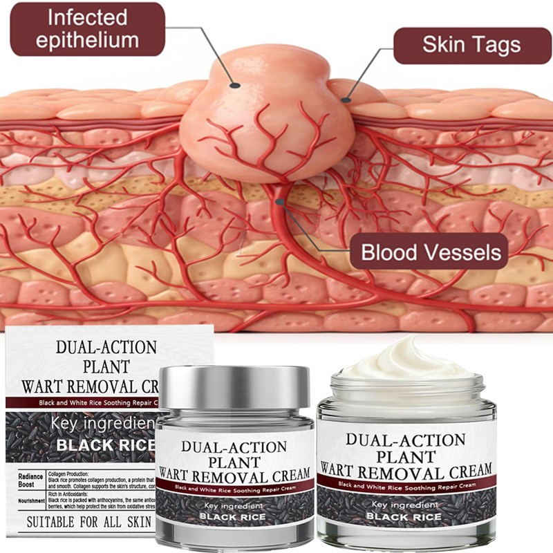 US Black Rice Soothing Cream, 60g Keraerase Dual- Action Renewal Cream - X4PCS