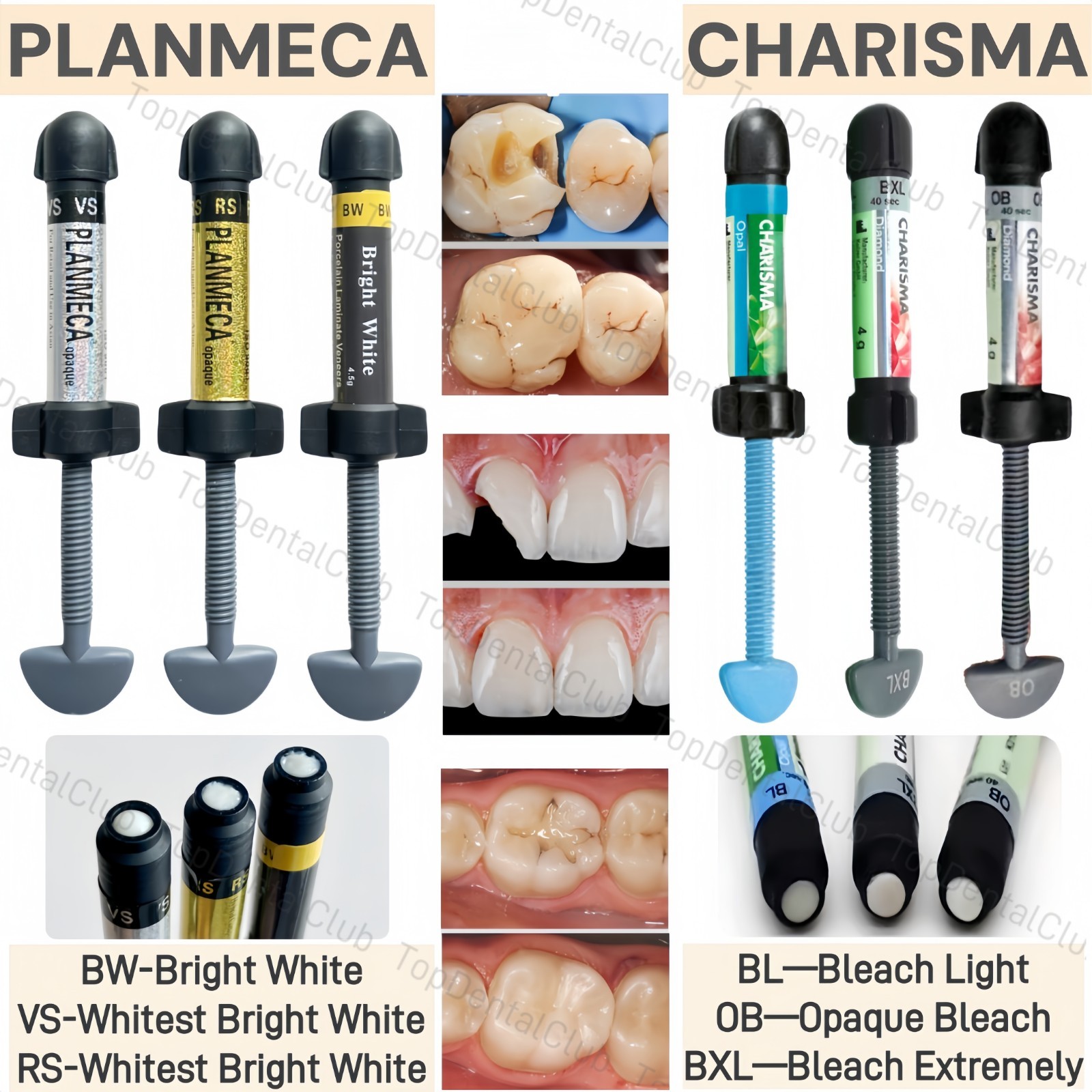 Dental Light Cure Veneer Composite Resin KULZER CHARISMA Diamond Brighte White