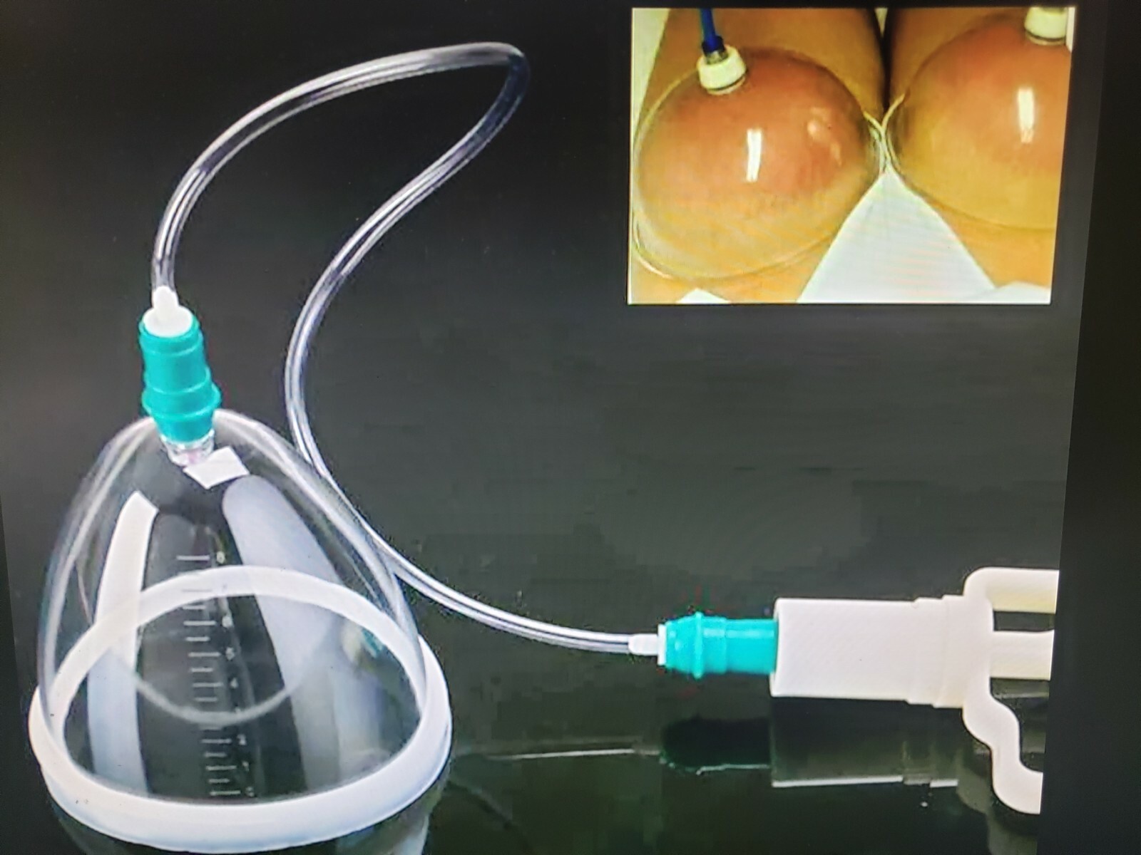 Breast Buttocks Enhancement Pump Lifting Vacuum Cupping Device