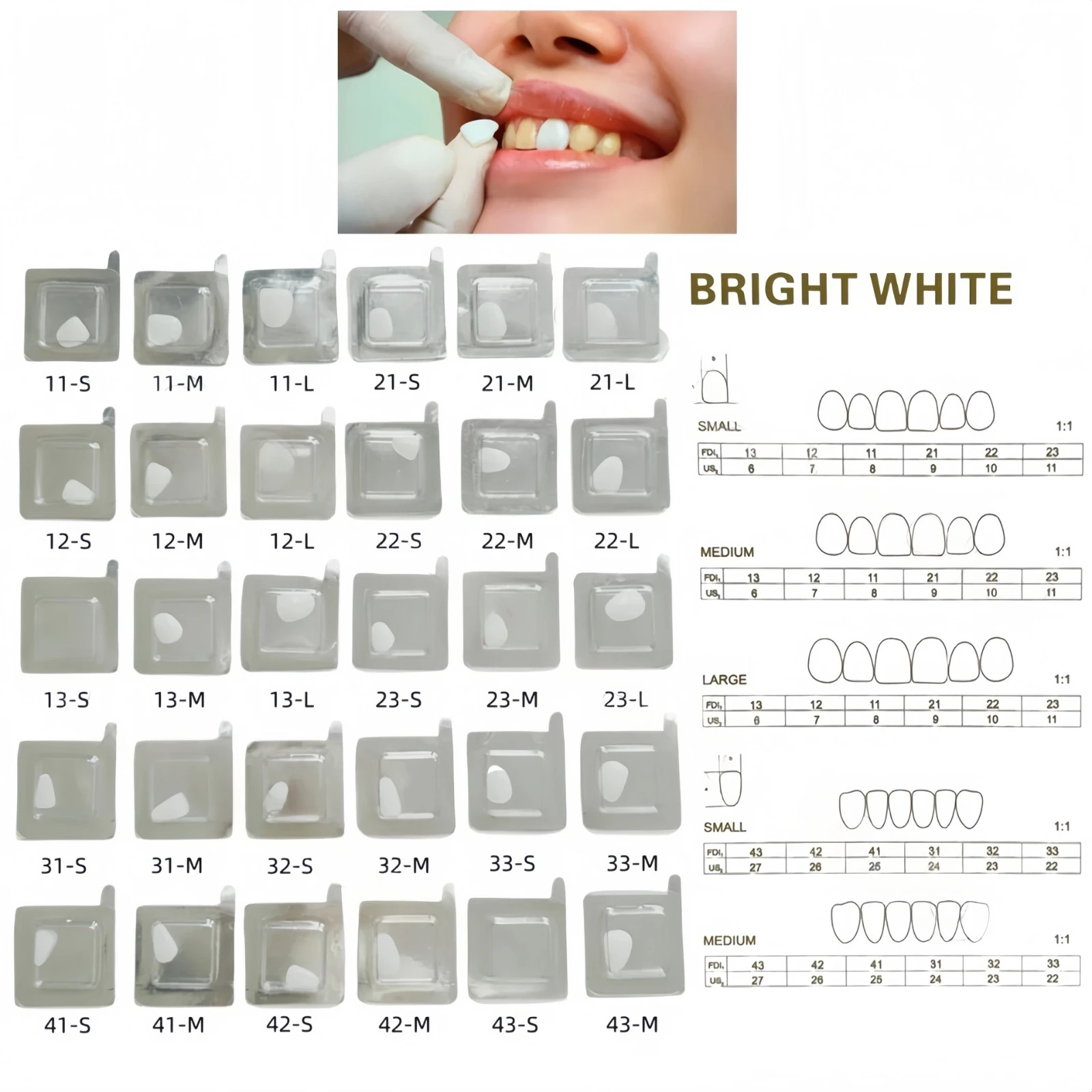 30Type Dental Composite Porcelain Veneers Light Cure Anterior Teeth Veneer Resin