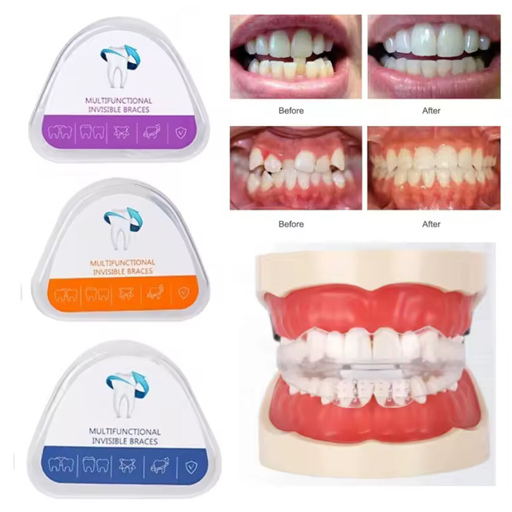 3 Stages Dental Orthodontic Teeth Corrector Braces New Adults Trainer Alignment
