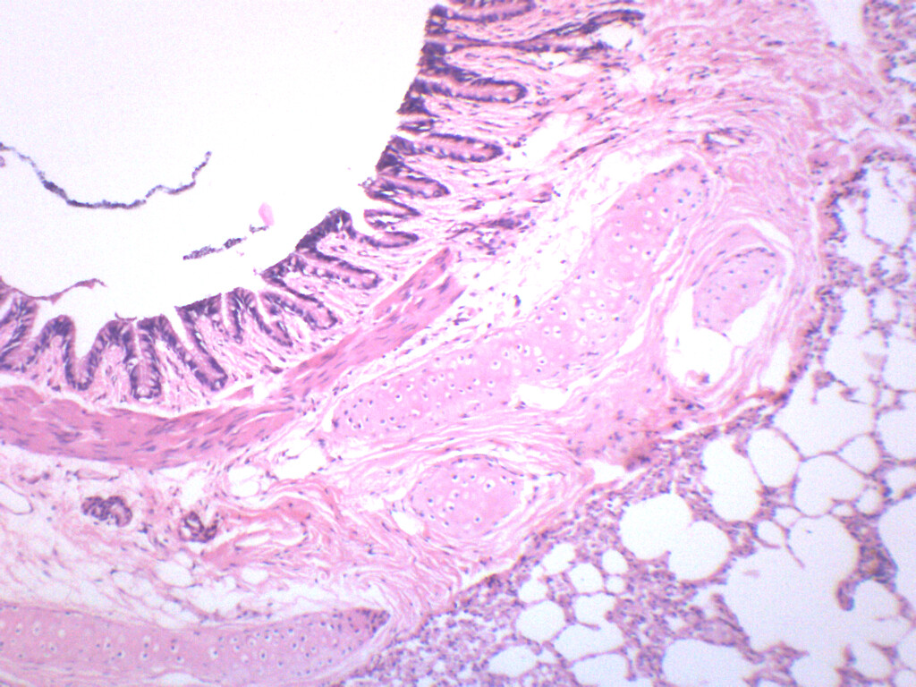 Human Lung Section - Prepared Microscope Slide - 75x25mm - Eisco Labs