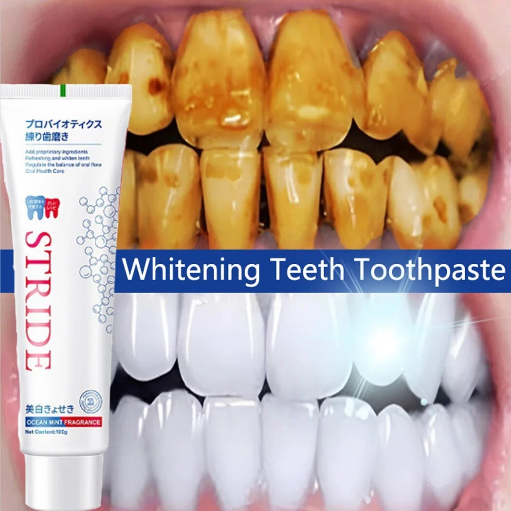 Pasta de dientes blanqueadora Removedor de calculo Dental previene Periodontitis