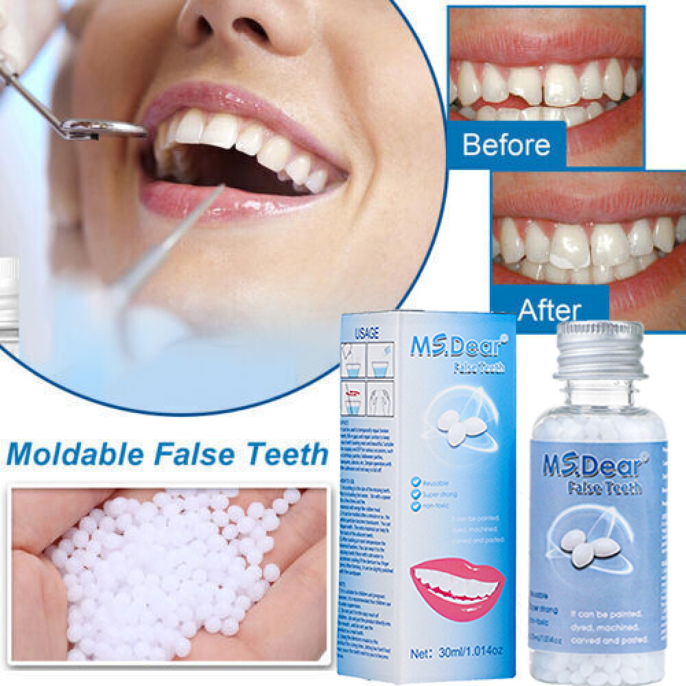 3X Tooth Repair Kit - Temporary Teeth Replacement Kit for Missing & Broken Teeth