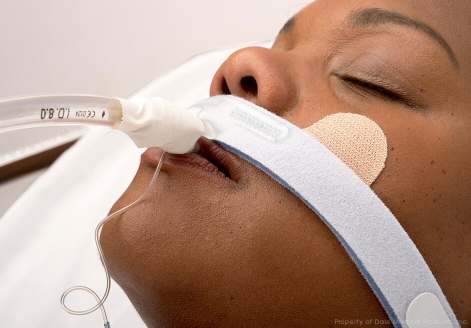 Dale (270) endotracheal Tube Holder, Fits Sizes 7.0mm-10.0mm