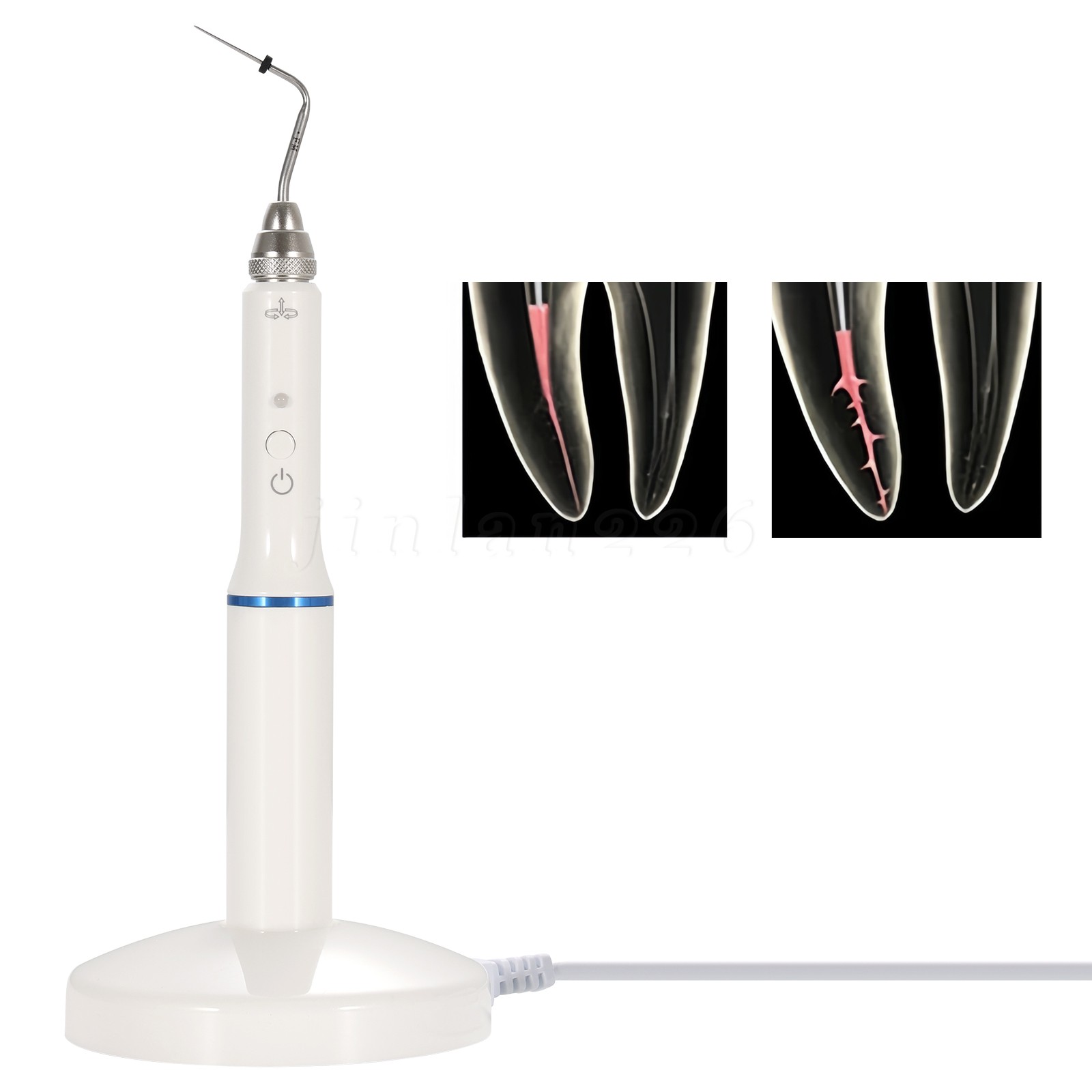 Dental Cordless Endo Gutta Percha Obturation System Endodontic Heated Pen