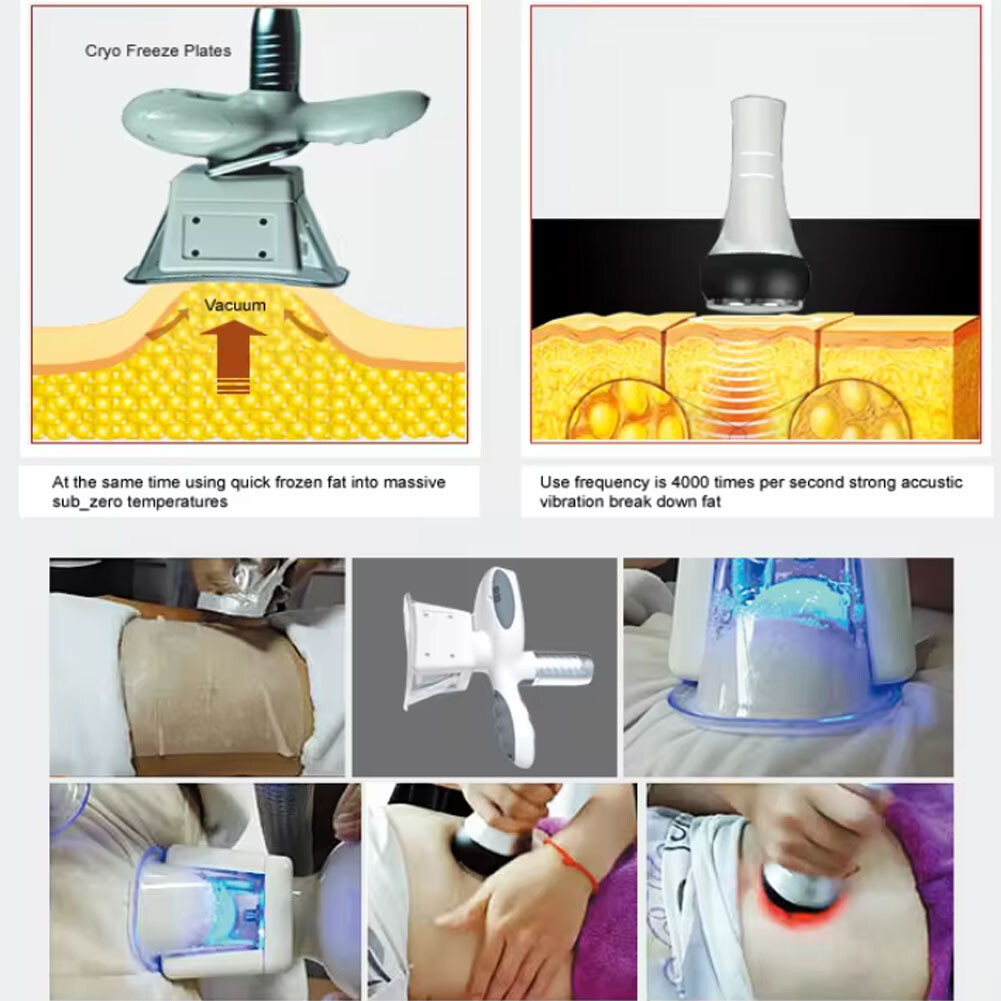 Cryolipolyse Slimming Machine Portable For Home Use Slimming machine
