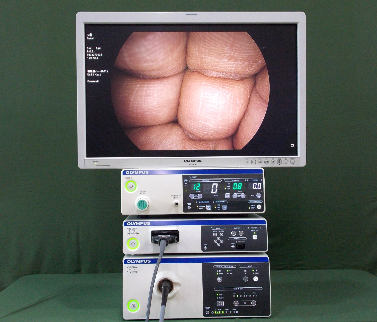 Olympus OTV-S190/CLV-S190/CH-S190-XZ-E/UHI-4 vs CYF-VH/ENF-VH/CV-180/190/CLV-190