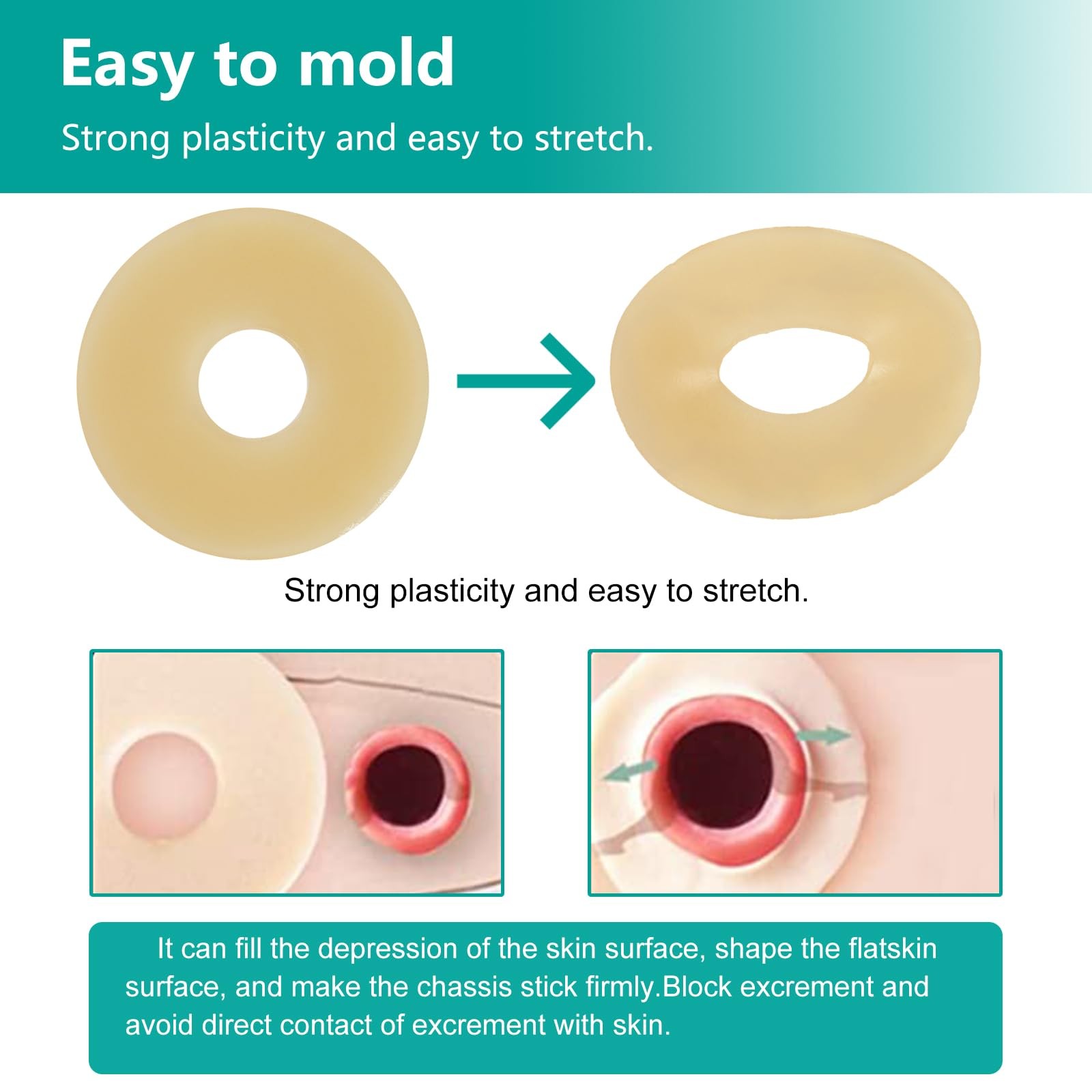 Ostomy Barrier Rings - Outer Diameter 2" 10PCS Rings, Beige