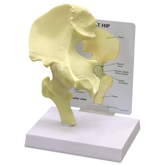 Hip Bone Joint GPI Anatomical Model LFA  # 1260. Make Us an Offer!