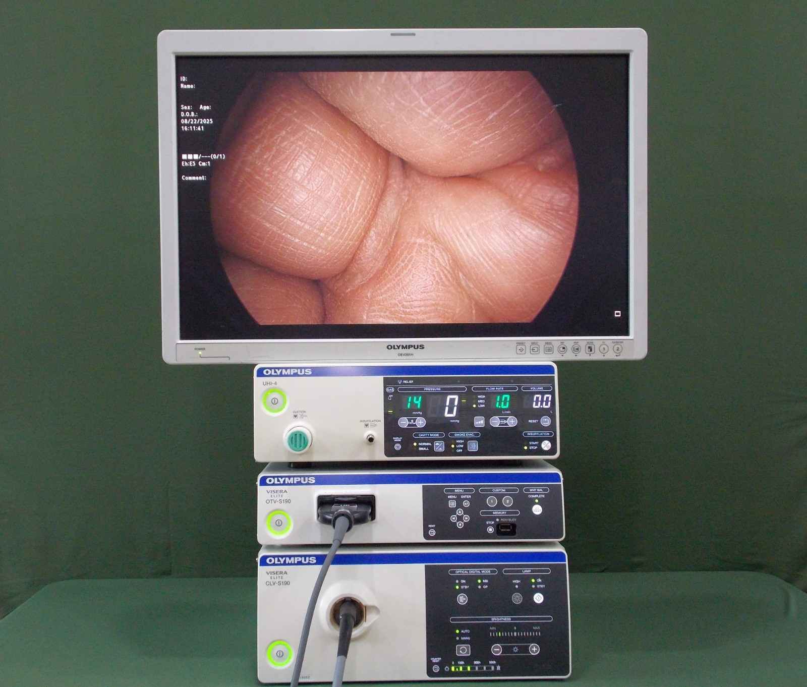 Olympus OTV-S190/CLV-S190/CH-S190-XZ-Q/UHI-4 vs CYF-VH/ENF-VH/CV-180/190/CLV-190