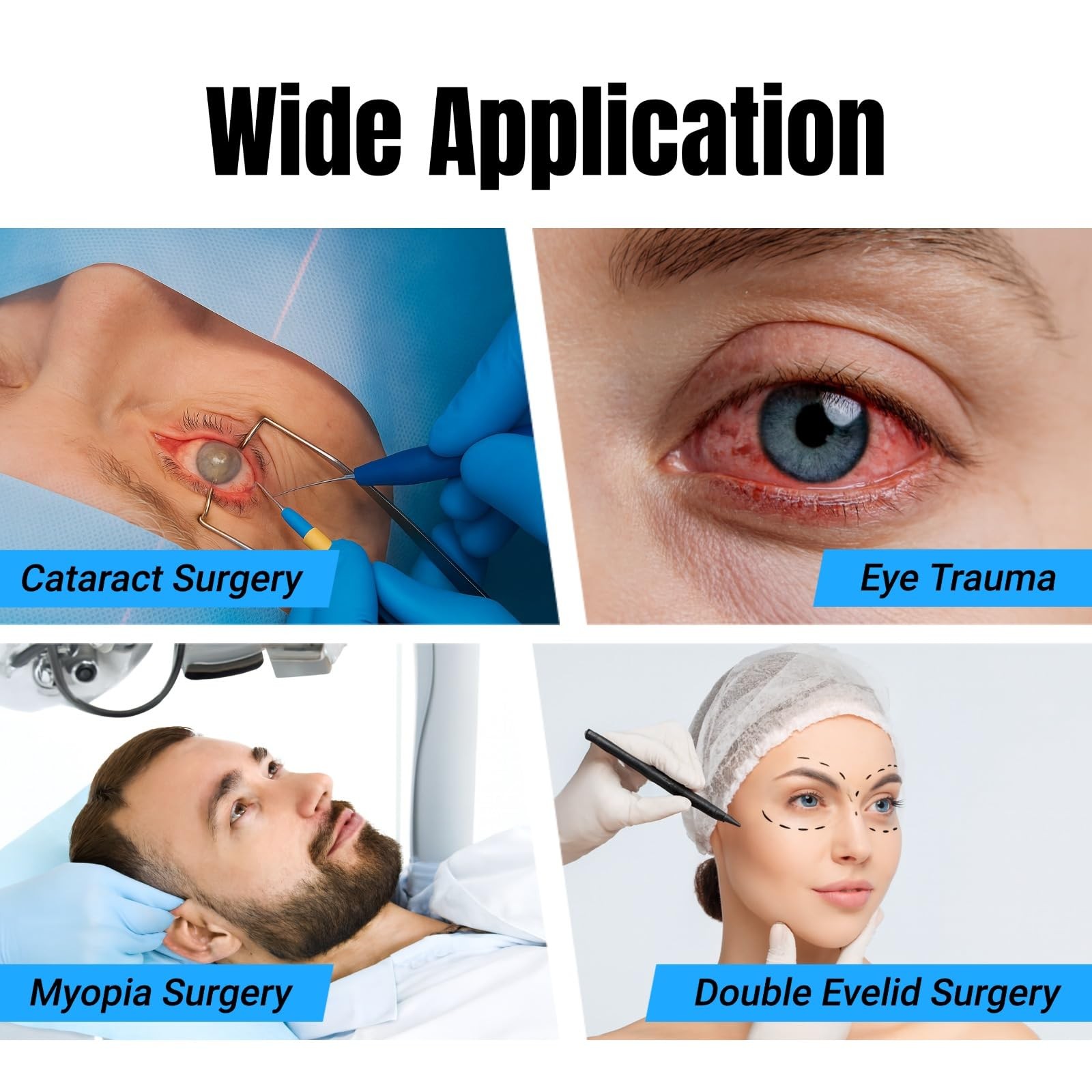 2PCS Eye Shield After Cataract Surgery, Cataract Eye Shield With Adjustable E...