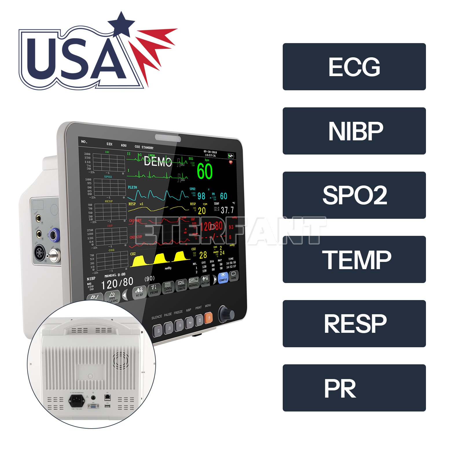 15.6" Patient Monitor ICU CCU Vital Sign For Hospital NIBP/RESP/TEMP/ECG/SPO2/PR