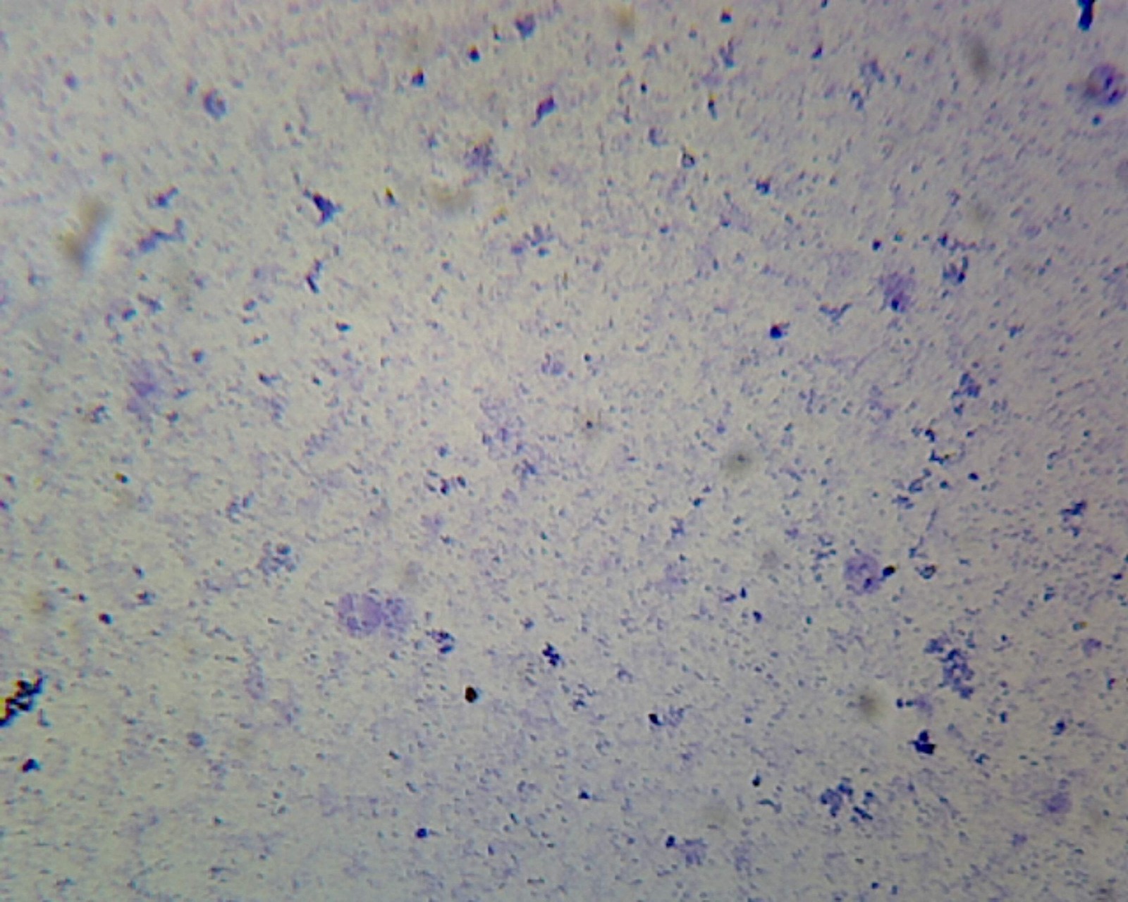 Coccus; Smear; Gram-Positive