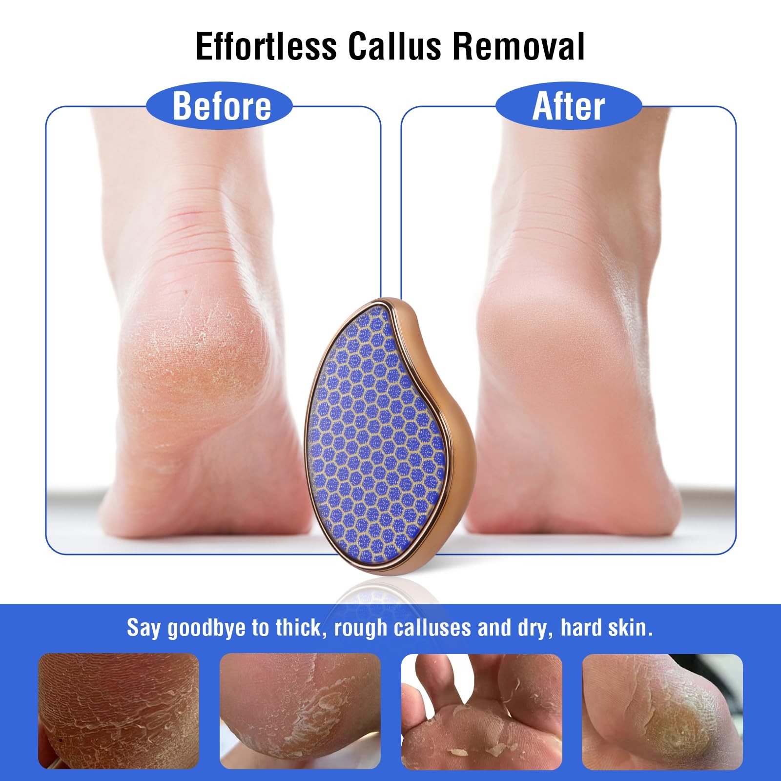 OUKEYA Glass Foot File Callus Remover: Nano 1 Count (Pack of 1), Blue