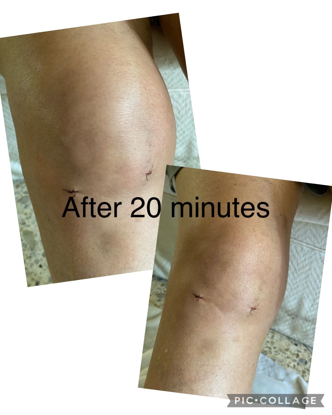 Amazing-O Stabilized Liquid Ozone Improves Energy, Oxygen, Nutrient Absorption
