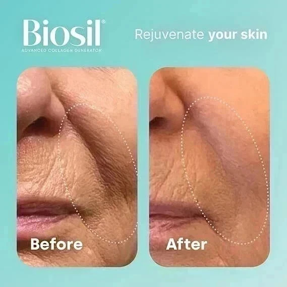Biosil Collagen Generator - 120 Original Capsules ( pack of 2 )