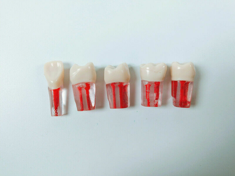 5pc Dental Root Canal Teeth Study Practice Model Endodontic Pulp Files Clear #11