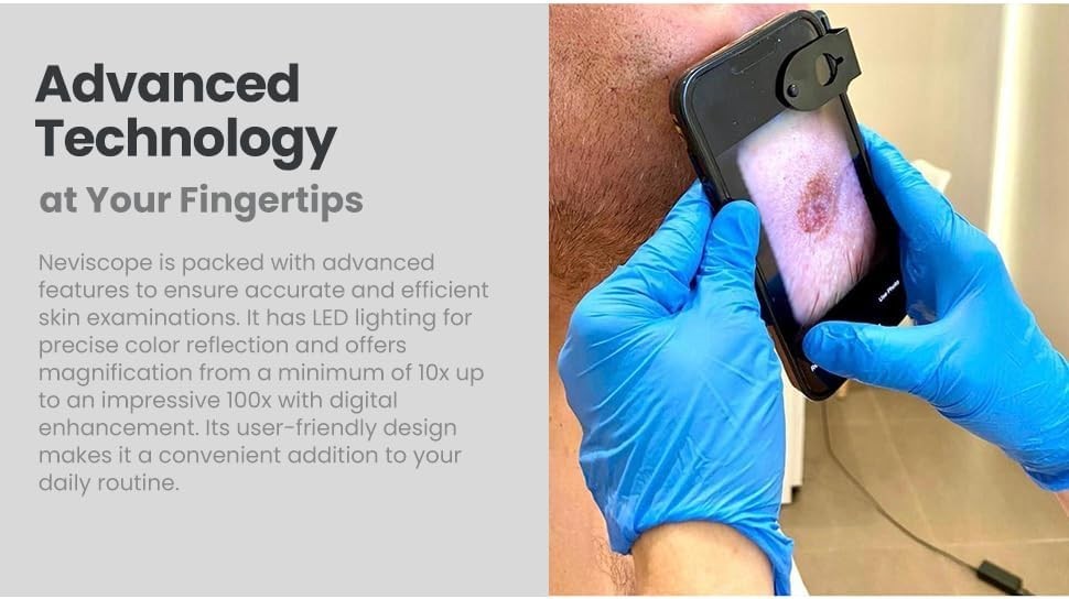 Neviscope Black Phone Dermatoscope Microscope with Polarized Lens/LED Light