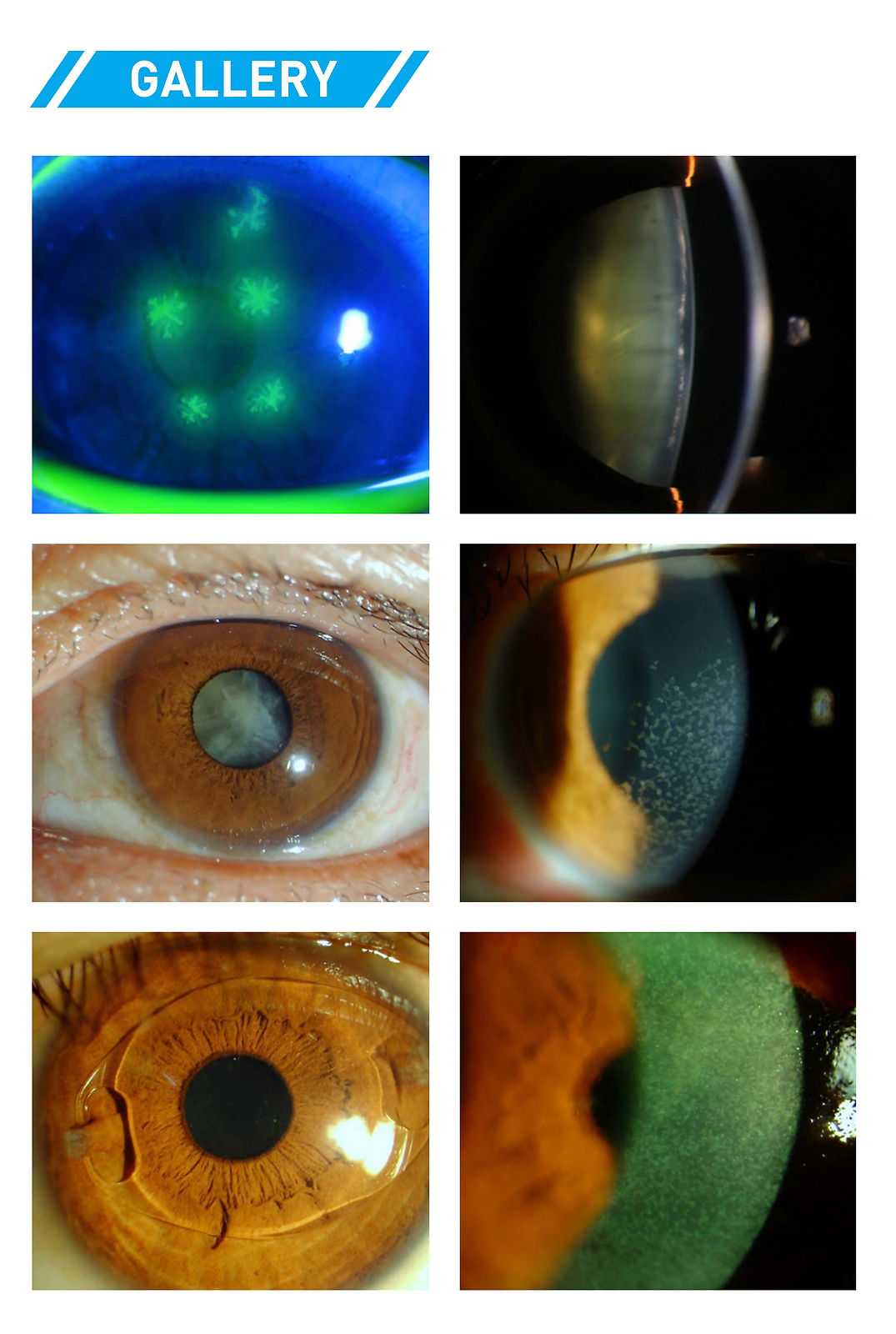 Five times magnification ophthalmic slit lamp optometry microscope