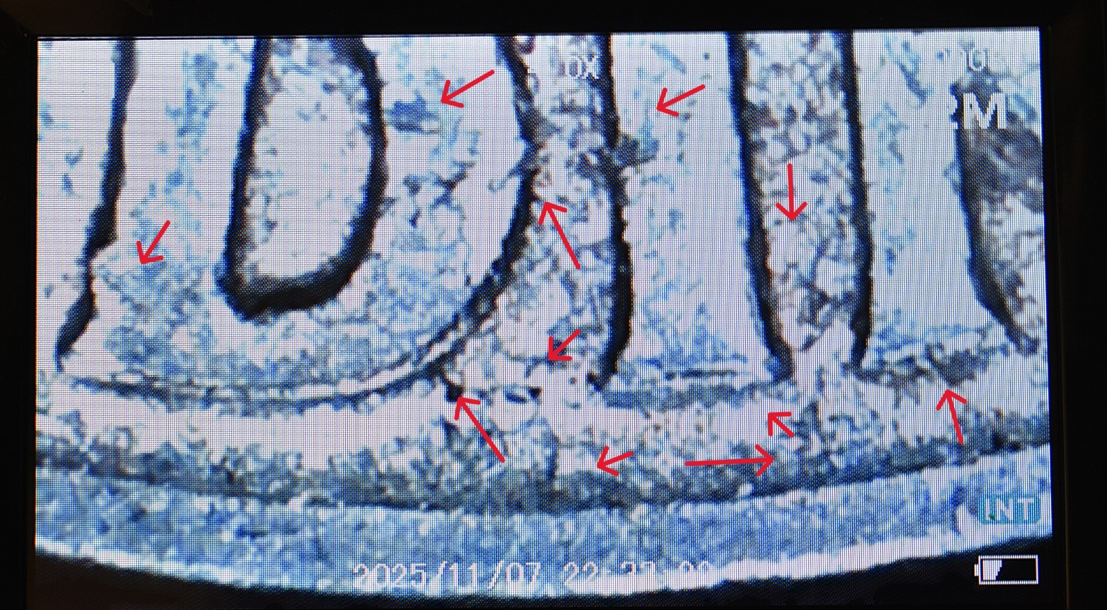 1964 D Silver Dime Multi Error Doubling Die Cracks Mint Fatigue Touching Letters