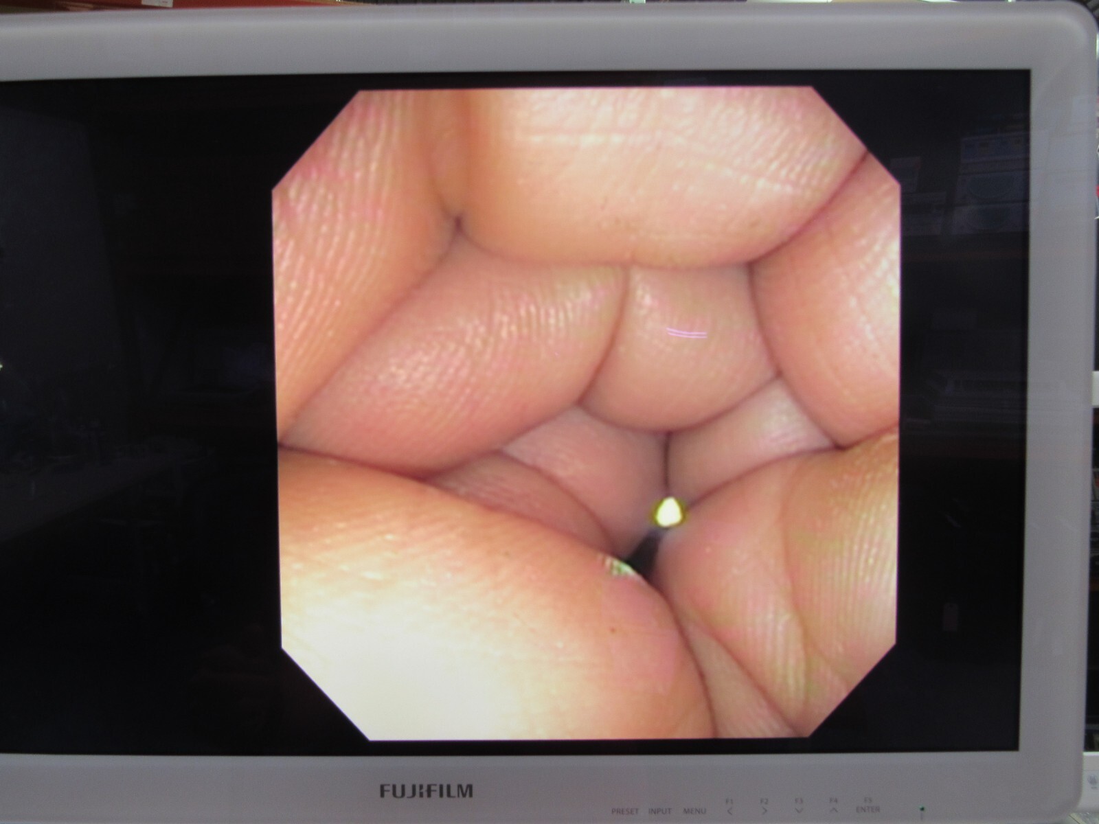 Olympus CF-140S Sigmoidoscope Endoscopy Endoscope