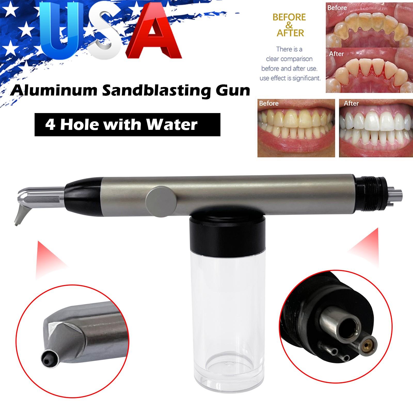 Alumina Air Polisher Abrasion Microetcher Sandblasting Gun 4Holes NEW Dental PR
