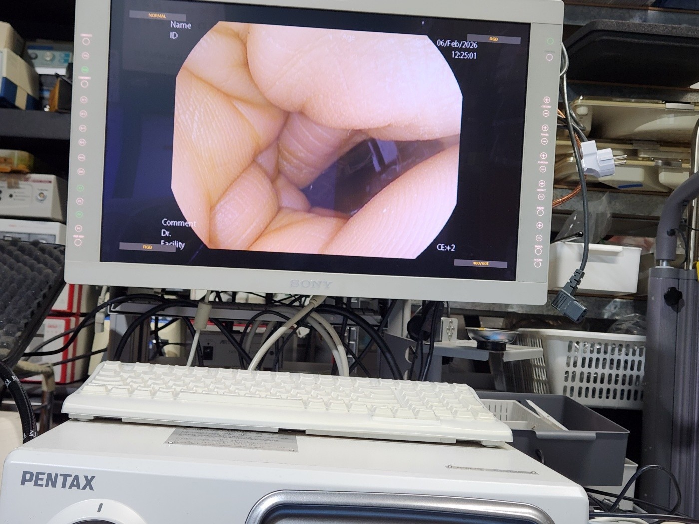 Pentax EPK-i7000 HD Endoscopy System