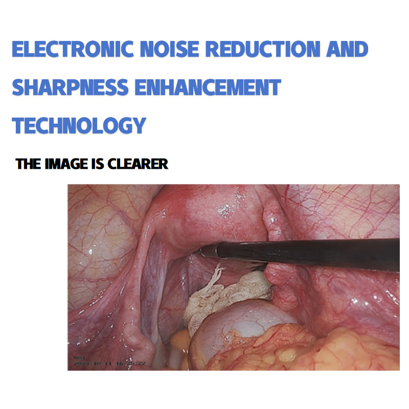 4k Endoscopy Laparoscopic Camera System Ultra HD Endoscope Camera Multiple surg