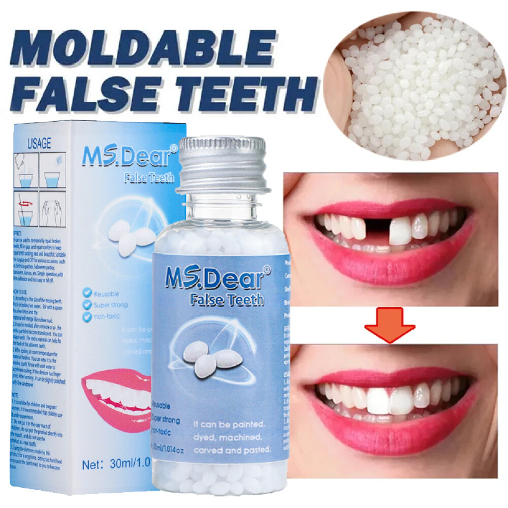 3X Tooth Repair Kit - Temporary Teeth Replacement Kit for Missing & Broken Teeth