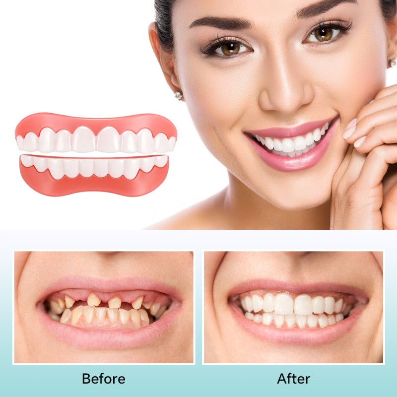 DIY Full Denture Set,Soft & Safe Moldable False Teeth Set,Upper & Lower Braces