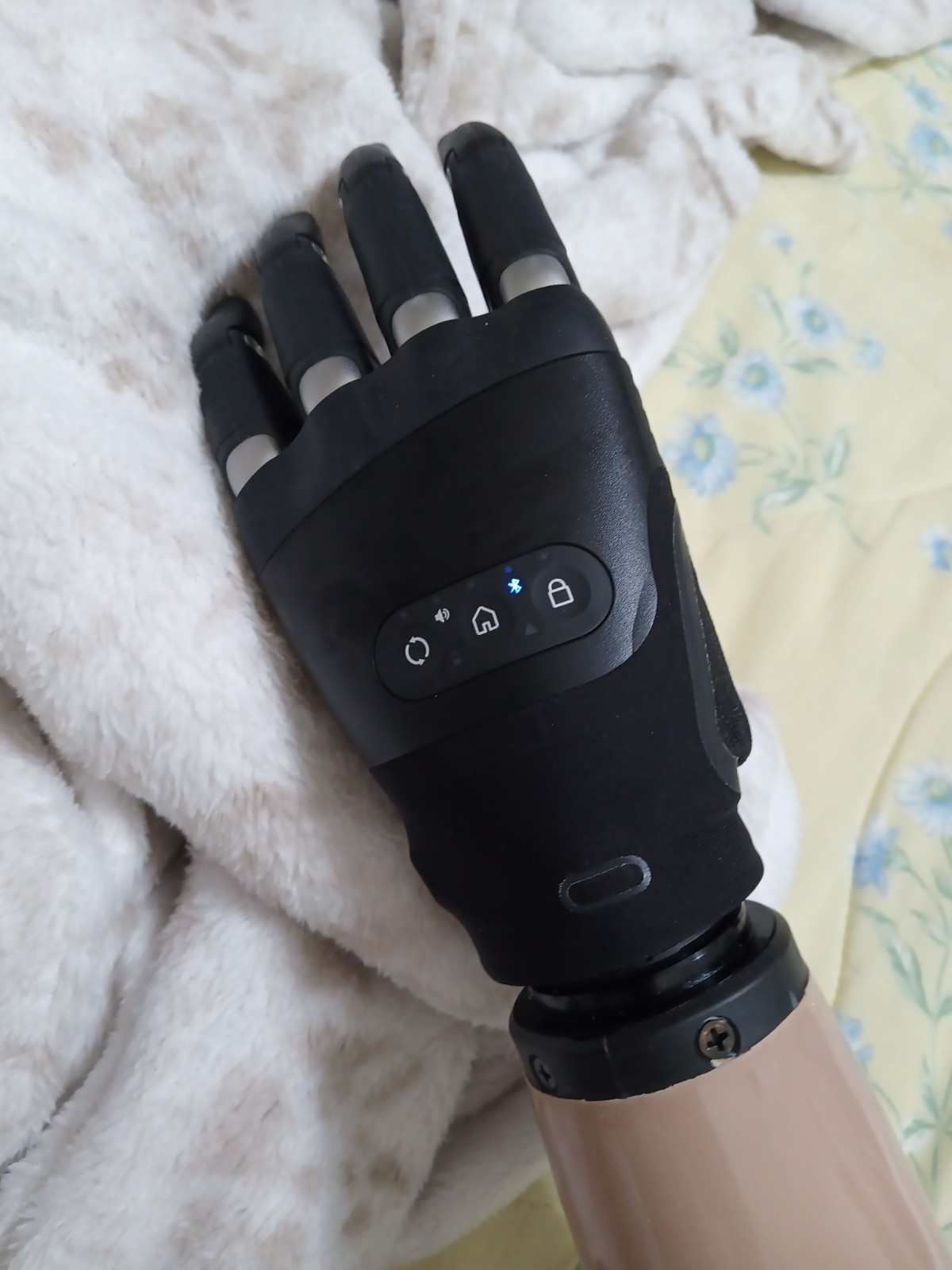 Touch Bionics i-Limb System Ottobock Myoelectric Prosthetic Hand Left
