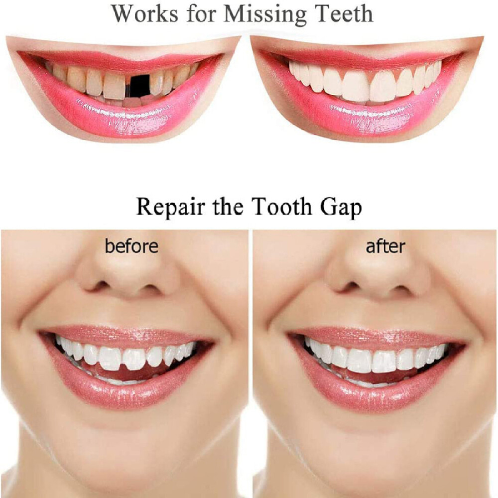 2PCS Tooth Repair Granules Temporary Reusable Moldable False Teeth Fitting Beads