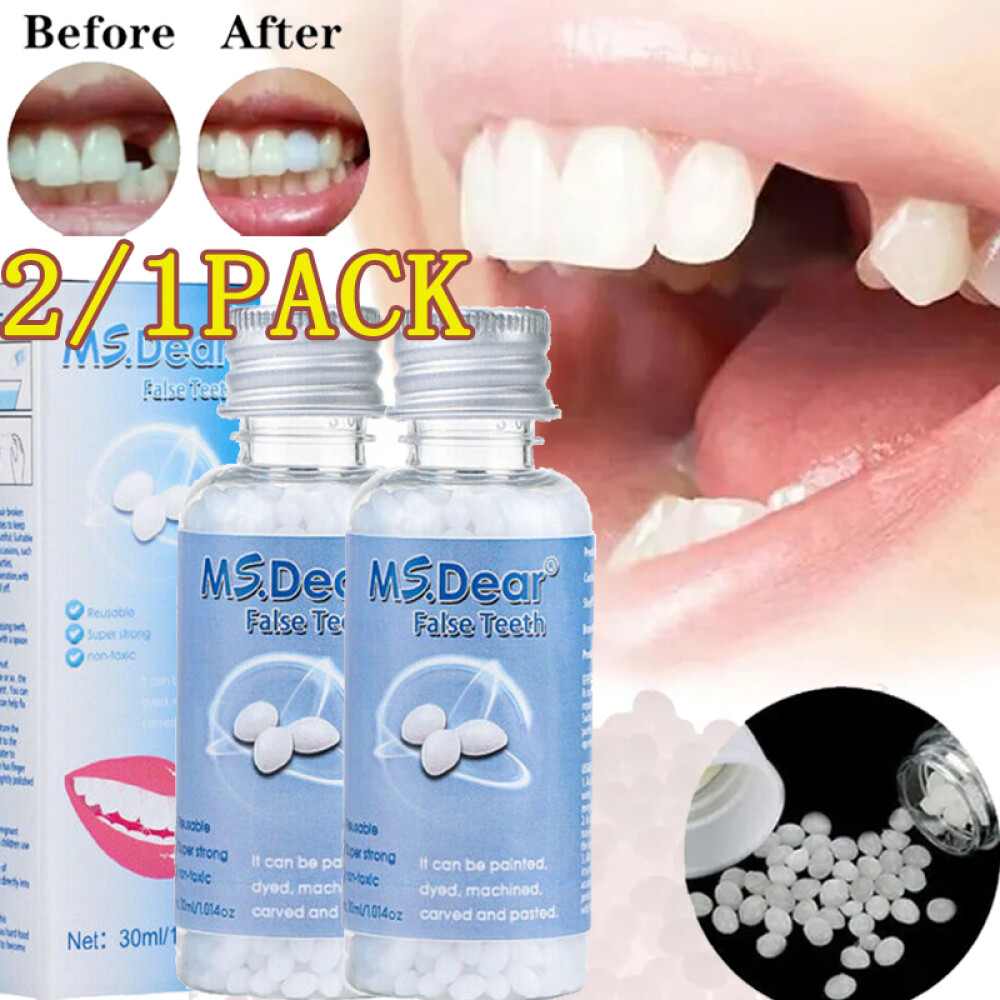 2/1Pcs Tooth Repair Beads Granules,Temporary Moldable Dental Pellets,False Teeth