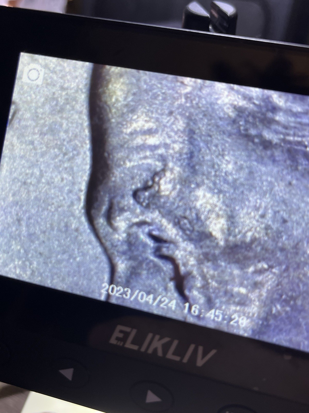 2015 P Dime With Multiple Errors!!! This Is Definitely A Gem. 🔥 See Pics! 😍