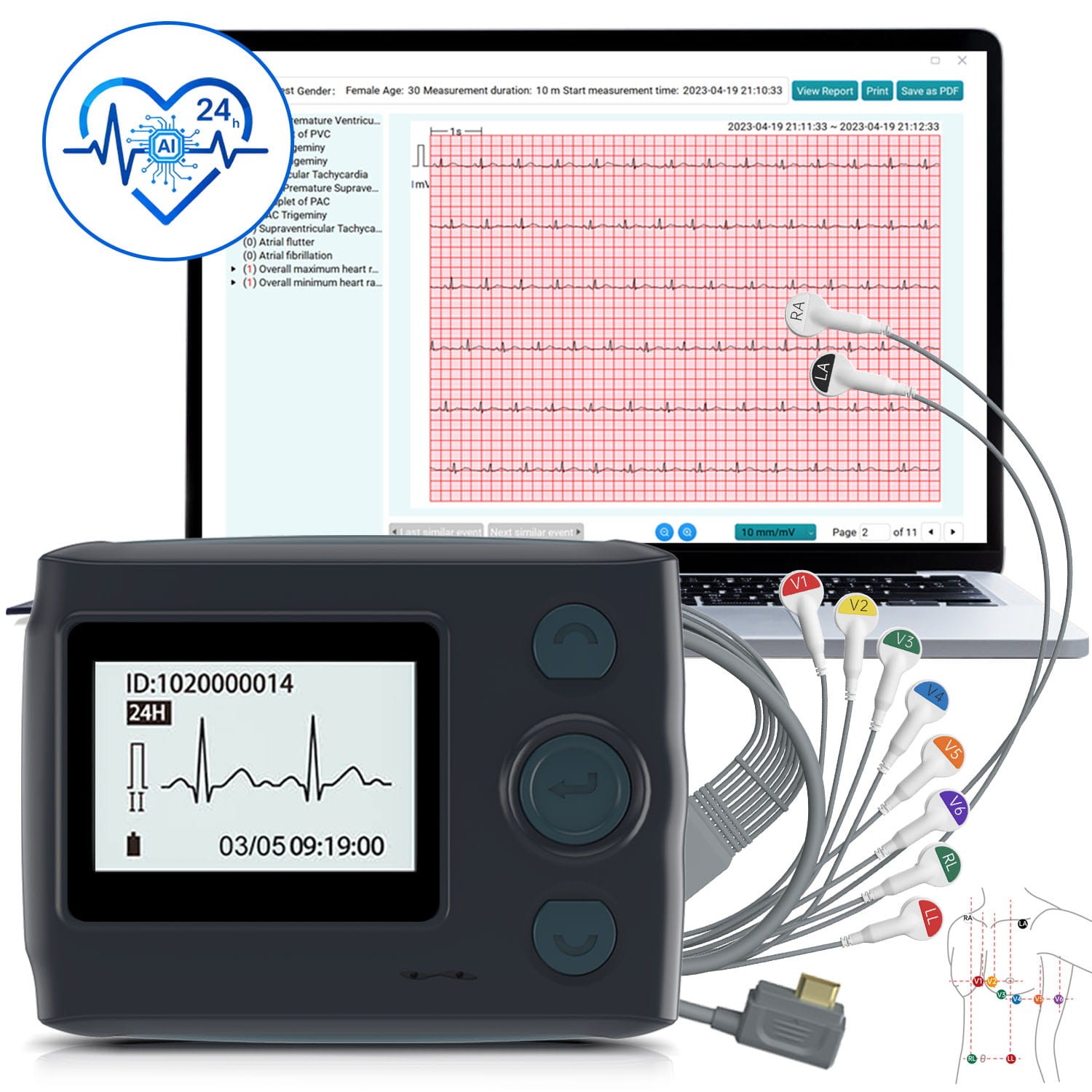12 Lead Holter Monitor Recording 24h ECG and Heart Rate AI Analysis Abnormal ECG