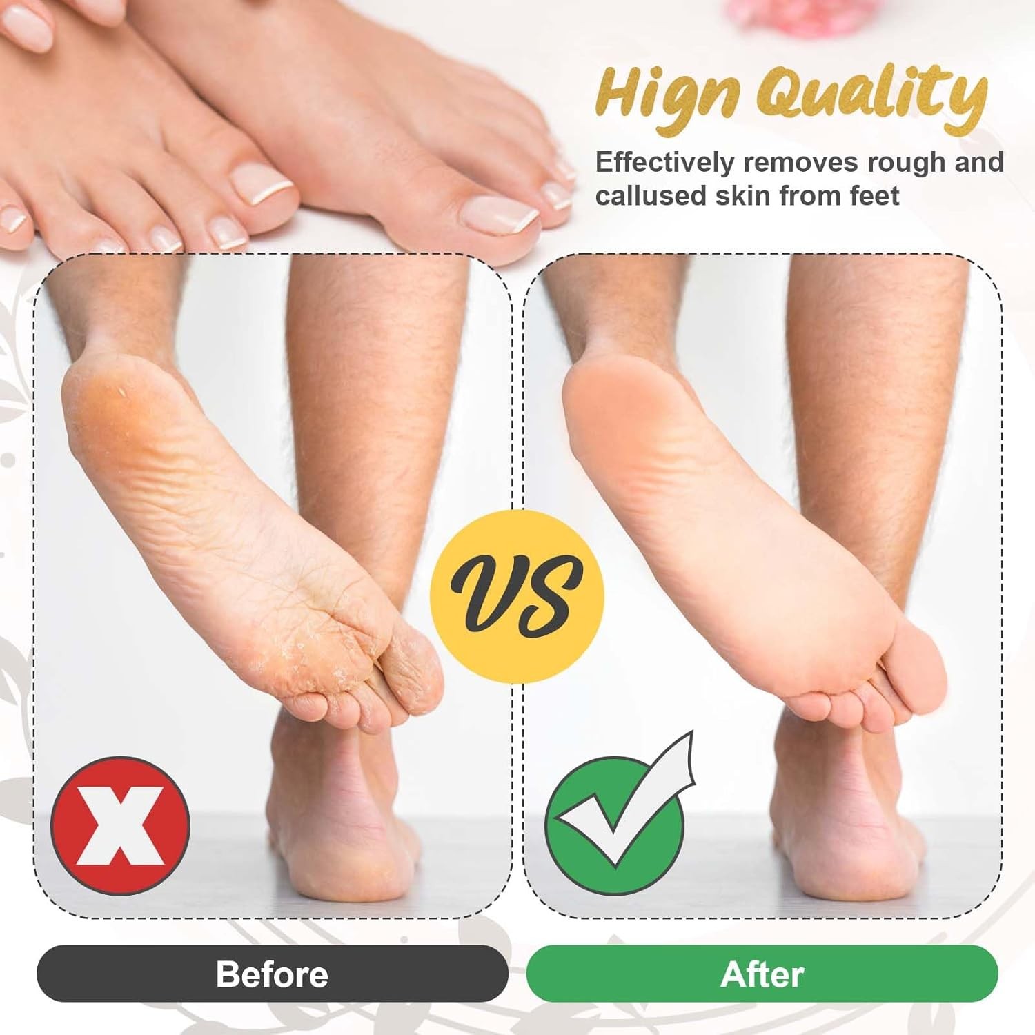 9 Pack Replacement Roller Heads for Electric Foot Callus Remover Refills Coarse