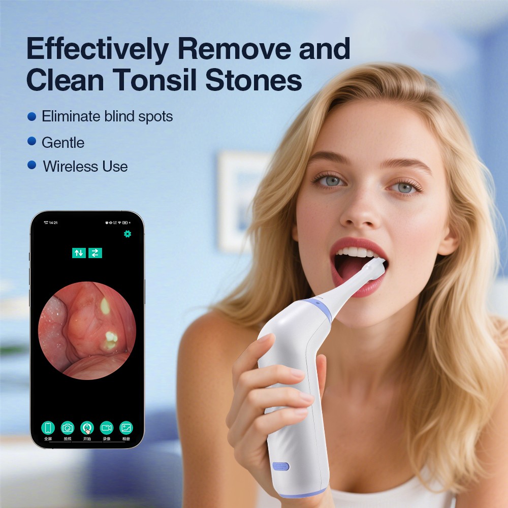 Visible Tonsil Stone Remover Kit with HD Camera, 3 Suction Levels, LED Light