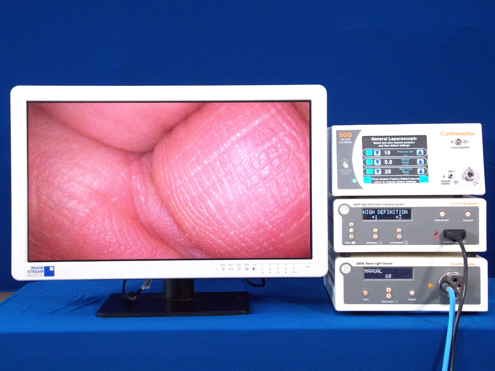 Dyonics 560P/500XL/Smith nephew 500 vs Stryker 1188/1288/Im4000/Storz image 1