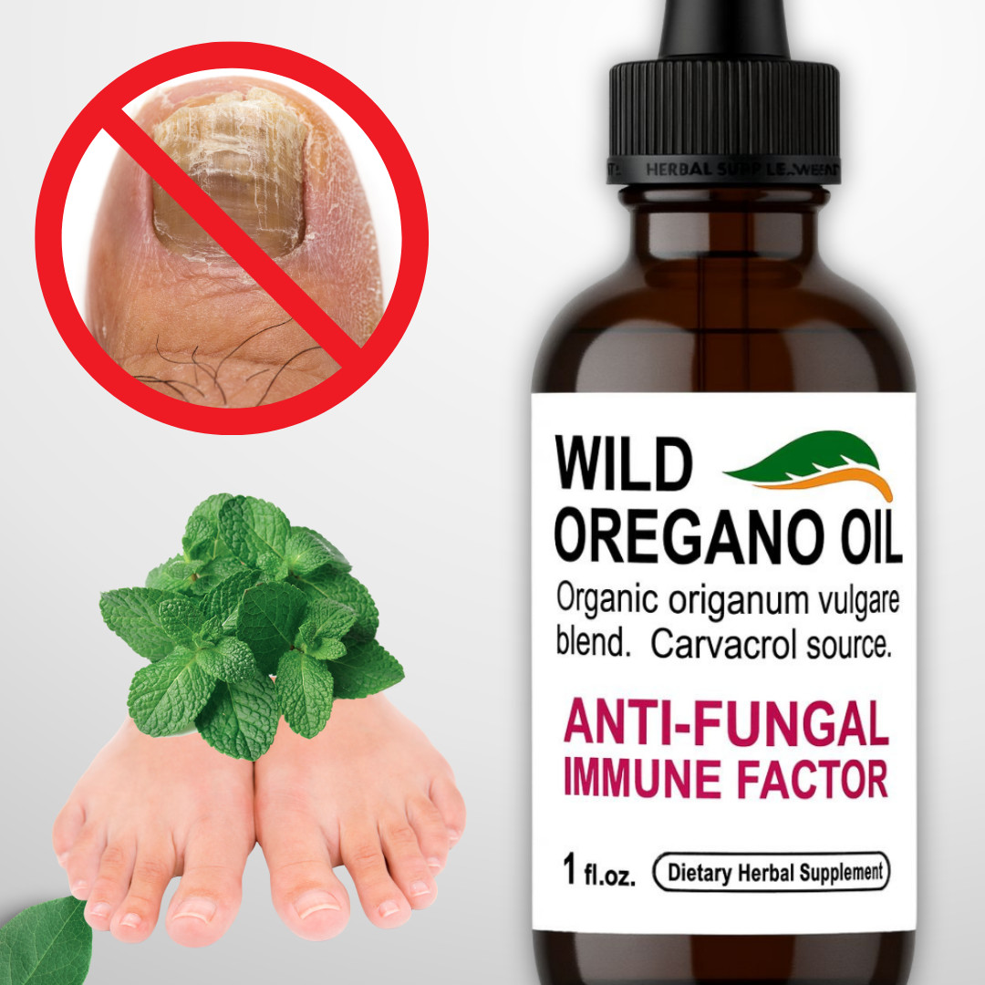 OREGANO ESSENTIAL OIL 30 ml 100% ORGANIC ANTIFUNGAL ANTI-FUNGAL Inmune support 