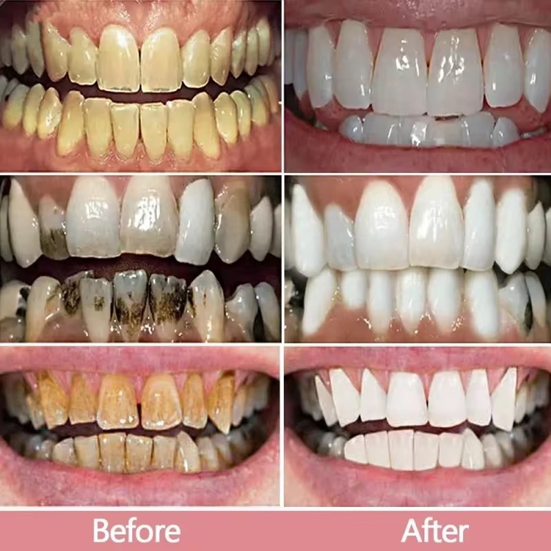 Nicotinamide Dazzling Whitening Toothpaste Nicotinamide Formula,Fresh Breath
