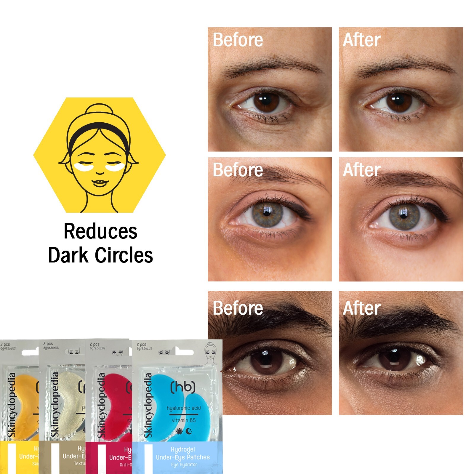 Skincyclopedia Caffeine & Matrixyl Eye Cream + Hydrogel Eye Pads - Dark Cricles