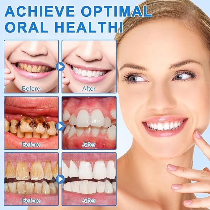 9.9% Hydroxyapatite Toothpaste, 4.23 Oz Nano Hydroxyapatite Toothpaste for Ename